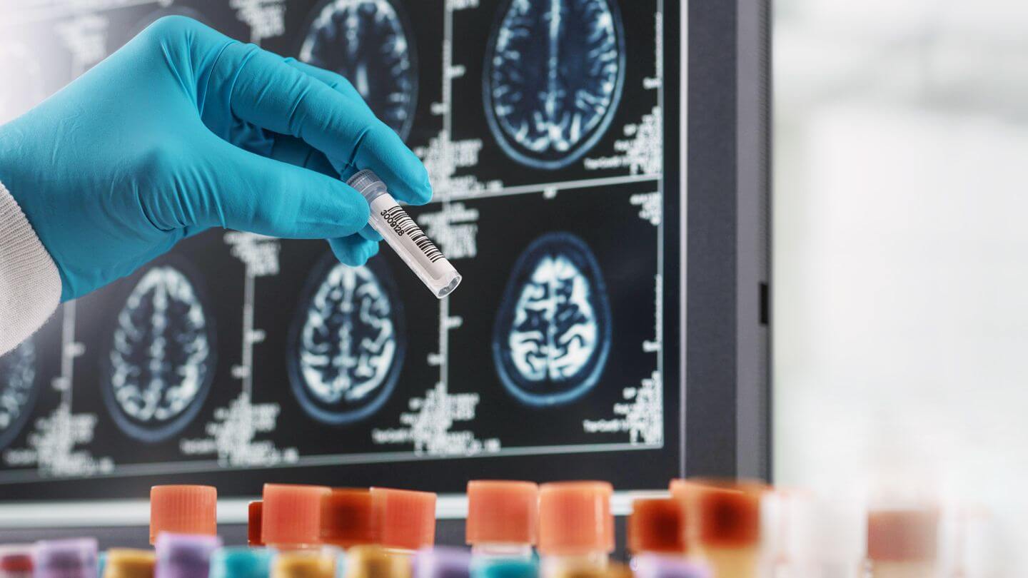 Neurological research